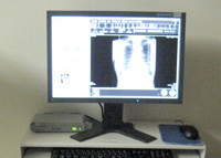 レントゲンデジタル撮影装置