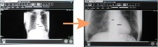 レントゲンデジタル撮影装置